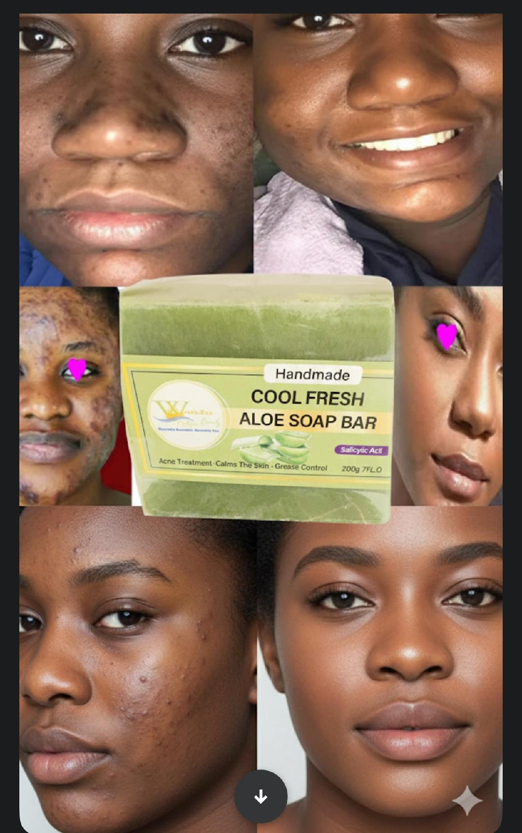Wanju Nature Beauty Handmade Aloe Soap Bar – Salicylic Acid Acne Treatment & Grease Control, 200g